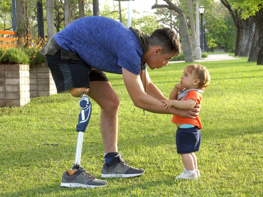 A father with a prosthetic leg leaning over to hold his young daughter